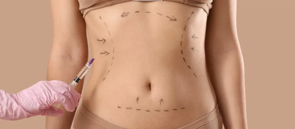 Liposuction-Ameliyati