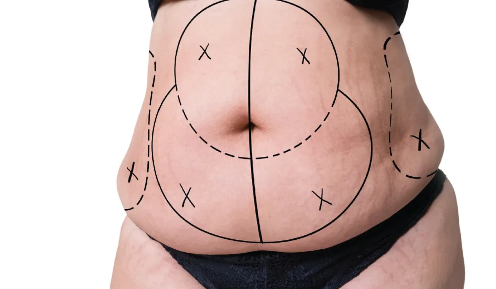 karin-germe-ameliyati
